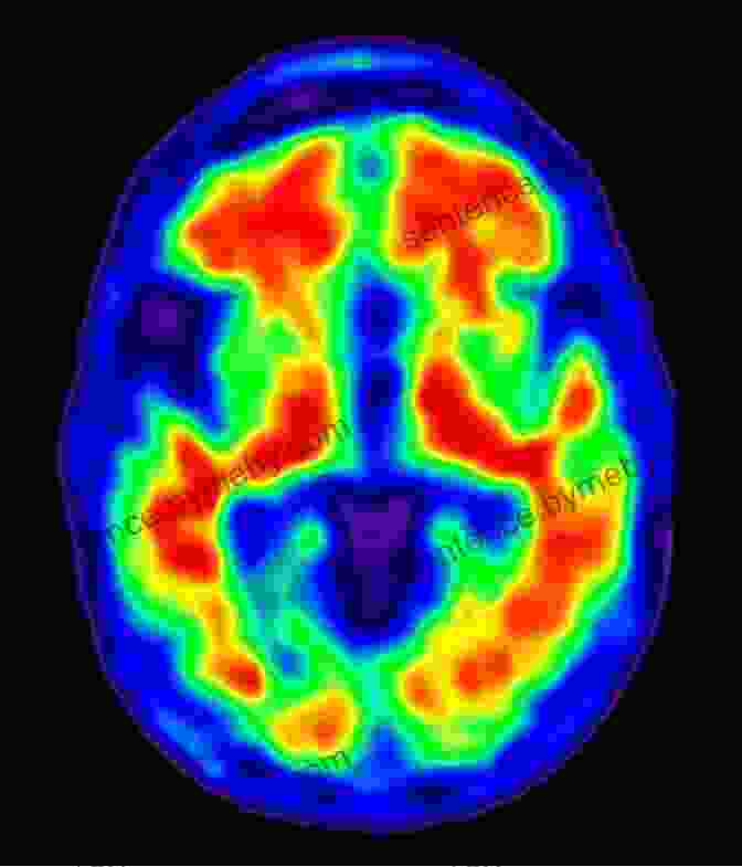 A Complex Brain Scan Of Professor Beaver's Neural Activity While Contemplating The Nature Of Consciousness Confessions Of A Professor Professor Beaver